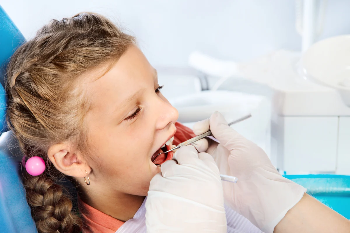 Do Baby Teeth Need Stainless Steel Crowns?